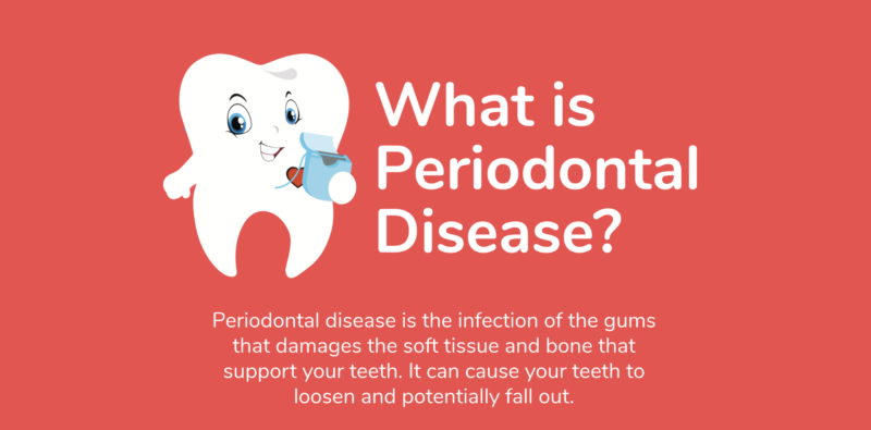 Infographic: Visual Guide to Periodontal Disease