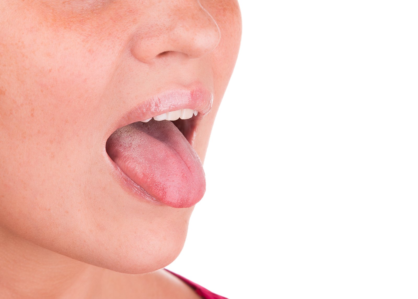 What Your Tongue Says About Your Health