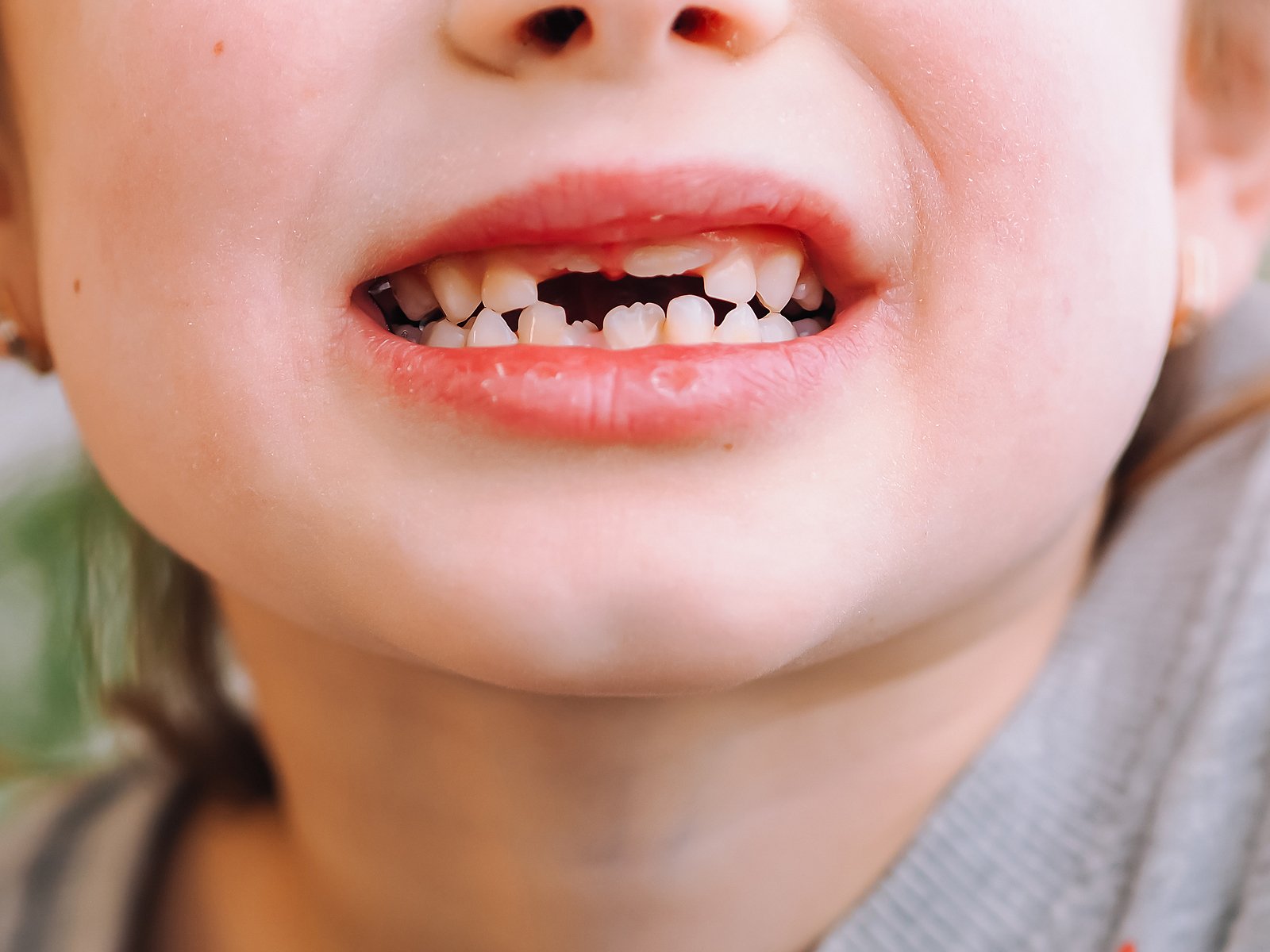 Tracking Your Child s Teeth Development